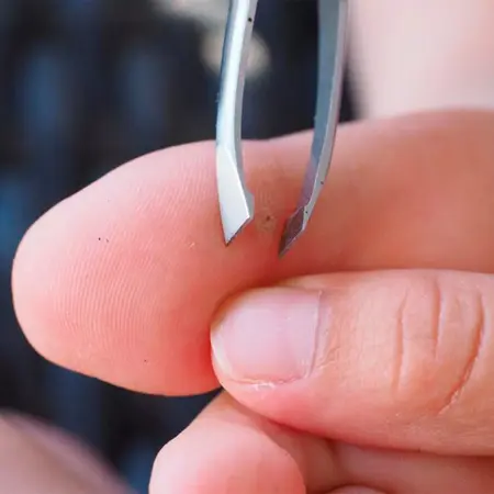 How to Remove a Splinter