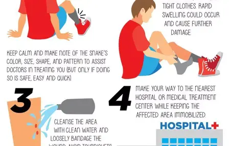 How to Treat a Snakebite