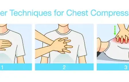 How to Perform Chest Compressions