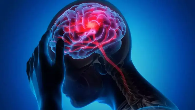 Wajah Mencong: Bedakan Bell's Palsy & Stroke - Kenali Gejalanya!