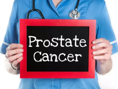Kanker Prostat: Deteksi Dini & Pengobatan di Indonesia