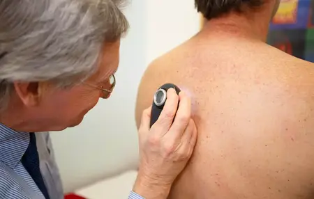 How to Do a Self-Check for Cancer