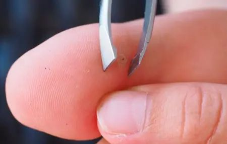 How to Remove a Splinter