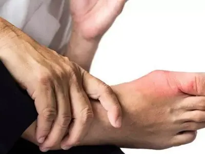 Makanan Asam Urat: Daftar Lengkap & Tips Mengatasinya