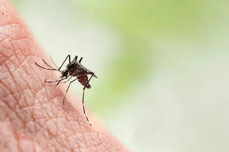 How to Get Rid of a Mosquito Bite