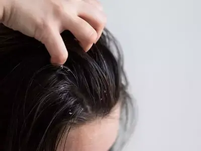 Atasi Gatal Kulit Kepala: 5 Langkah Praktis & Efektif