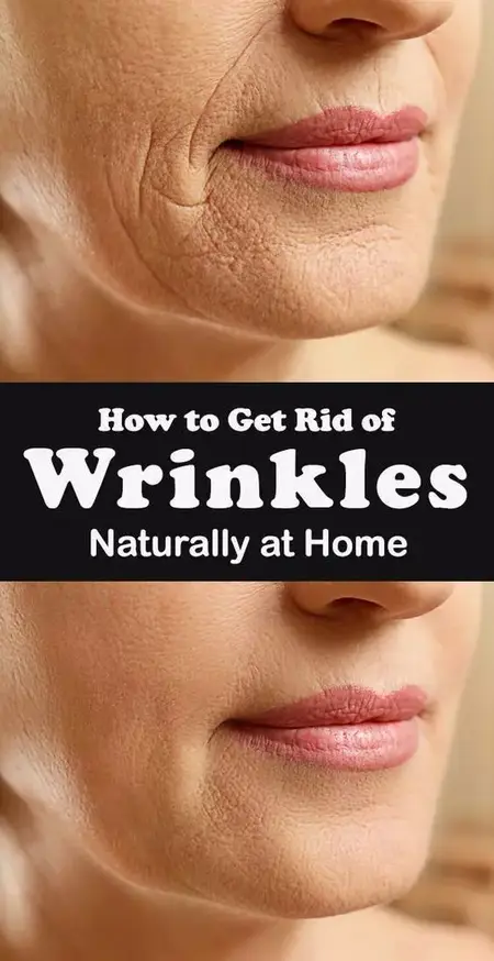 How to Get Rid of Wrinkles