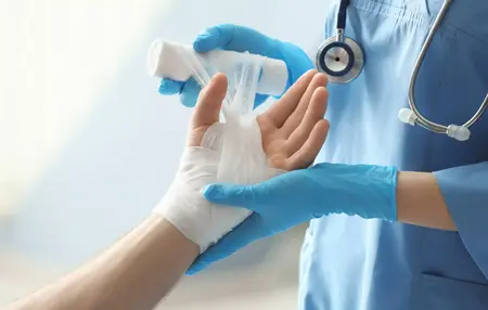 How to Get Rid of a Burn