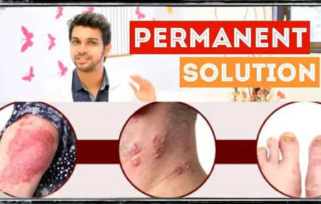 How to Get Rid of a Skin Infection