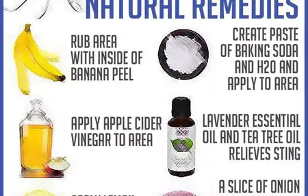 How to Get Rid of Mosquito Bites