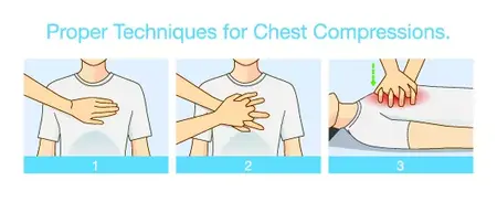 How to Perform Chest Compressions