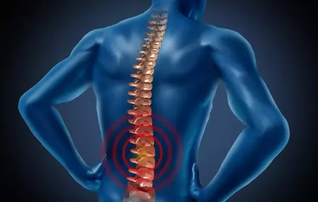 How to Get Rid of Back Pain