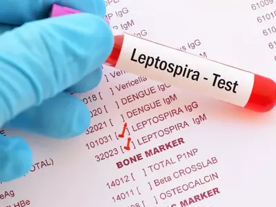 Pencegahan Leptospirosis: Lindungi Diri di Musim Hujan