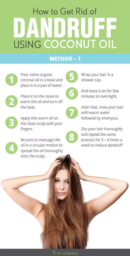 How to Get Rid of Dandruff