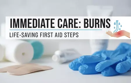 How to Administer First Aid for Burns