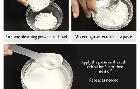 How to Get Rid of a Rash