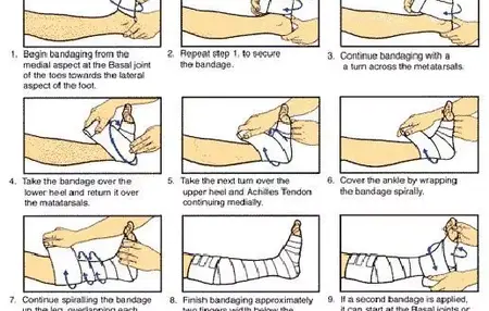How to Give a Bandage