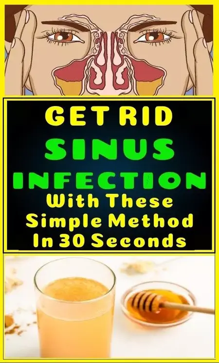 How to Get Rid of a Sinus Infection
