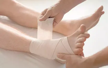 How to Treat a Sprain