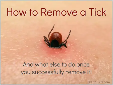 How to Get Rid of a Tick