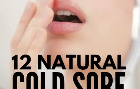 How to Get Rid of a Cold Sore
