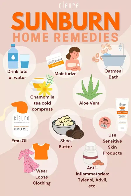 How to Heal a Sunburn