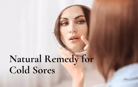 How to Get Rid of a Cold Sore