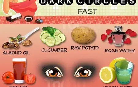 How to Get Rid of Dark Circles Under Eyes