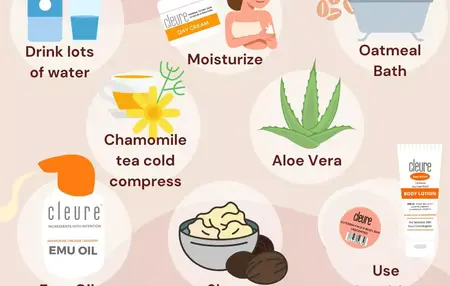 How to Heal a Sunburn