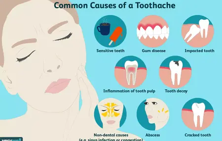 How to Deal with a Toothache