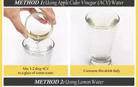 How to Get Rid of Headaches Naturally