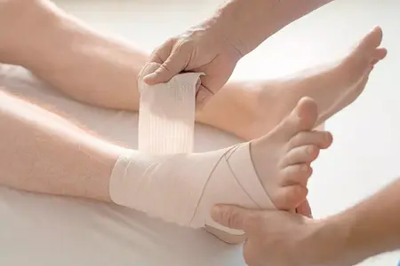 How to Treat a Sprain