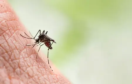 How to Get Rid of a Mosquito Bite
