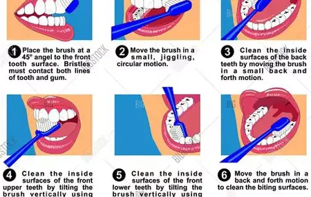 How to Clean Your Teeth Properly