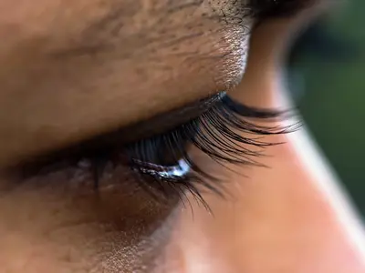 Mata Panda: Penyebab, Faktor Risiko, & Cara Menghilangkannya