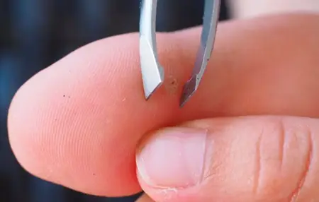 How to Get Rid of a Splinter