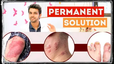 How to Get Rid of a Skin Infection