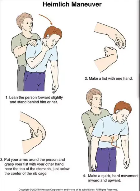 How to Give the Heimlich Maneuver